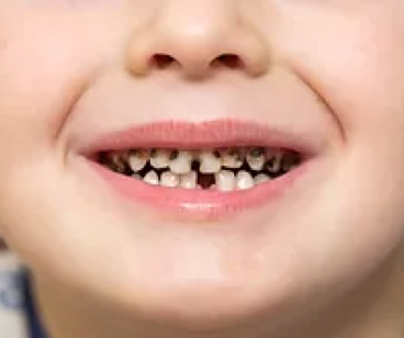 Pleasant Mill Pediatric Dentistry